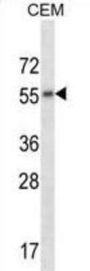 Muscarinic Acetylcholine Receptor M2 (CHRM2) Antibody
