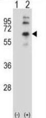 Muscarinic Acetylcholine Receptor M2 (CHRM2) Antibody