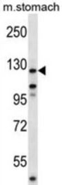 Mouse Ptk2 Antibody