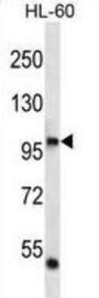 DNA Polymerase Iota (POLI) Antibody
