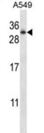 Ras-Related Protein Rab-11A (RAB11A) Antibody