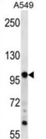 Targeting Protein For Xklp2 (TPX2) Antibody
