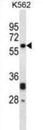 Glycylpeptide N-Tetradecanoyltransferase 2 (NMT2) Antibody