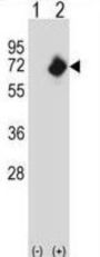 Glycylpeptide N-Tetradecanoyltransferase 2 (NMT2) Antibody