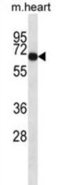 Mouse Adck1 Antibody