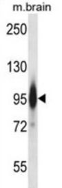 Mouse Prkce Antibody
