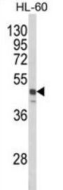 Sorting Nexin 6 (SNX6) Antibody
