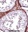 T-Box Protein 5 (TBX5) Antibody