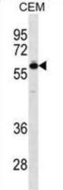T-Box Protein 5 (TBX5) Antibody