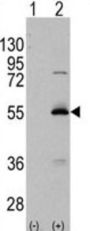 Methylmalonate-Semialdehyde Dehydrogenase [acylating], Mitochondrial (ALDH6A1) Antibody