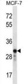 GRB2 Related Adaptor Protein 2 (GRAP2) Antibody
