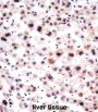 U1 Small Nuclear Ribonucleoprotein A (SNRPA) Antibody