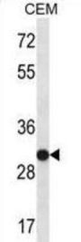 U1 Small Nuclear Ribonucleoprotein A (SNRPA) Antibody