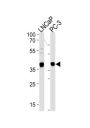 Vitamin D3 Receptor (VDR) Antibody