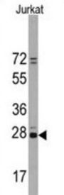 CD9 Antigen (CD9) Antibody