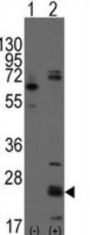 CD9 Antigen (CD9) Antibody