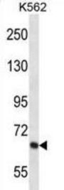 KCND2 Antibody