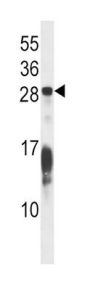 RAP1B Antibody