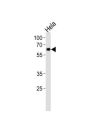 Nuclear Receptor Subfamily 1 Group D Member 2 (NR1D2) Antibody