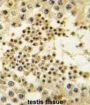 Lin-28 Homolog B (LIN28B) Antibody