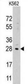 Lin-28 Homolog B (LIN28B) Antibody