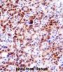 Serine Protease 27 (PRSS27) Antibody