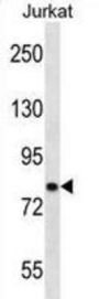 Voltage-Dependent L-Type Calcium Channel Subunit Beta-2 (CACNB2) Antibody