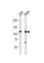Sal-Like Protein 4 (SALL4) Antibody