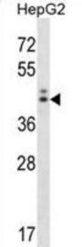 Neuroguidin (NGDN) Antibody