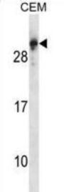 Regulator Of G Protein Signaling 5 (RGS5) Antibody