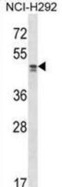 Transcriptional Adaptor 2A (TADA2L) Antibody