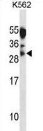 Myogenin (MYOG) Antibody