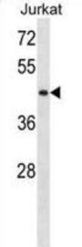 Serine/Threonine Kinase 33 (STK33) Antibody
