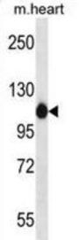 ACTN2 Antibody