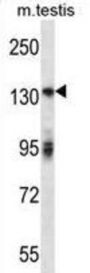 Receptor Tyrosine-Protein Kinase ErbB-2 (ERBB2) Antibody
