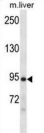Doublecortin Like Kinase 1 (Dclk1) Antibody