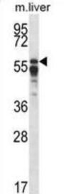 Protein Phosphatase 2 Regulatory Subunit B'Alpha (PPP2R5A) Antibody