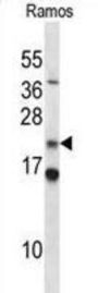 COP9 Signalosome Subunit 8 (COPS8) Antibody