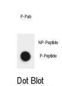 ATRIP (phospho-Ser239) Antibody
