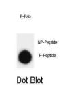 SNAP25 (pT138) Antibody