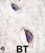 Dickkopf-Related Protein 3 (DKK3) Antibody