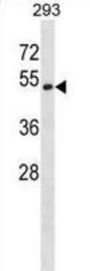 Dickkopf-Related Protein 3 (DKK3) Antibody