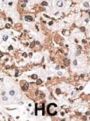 KChIP3 Antibody