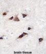 KChIP3 Antibody