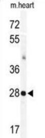 KChIP3 Antibody