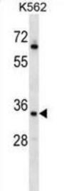 RAD1 Antibody