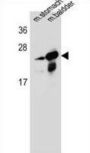 RAB25, Member RAS Oncogene Family (RAB25) Antibody