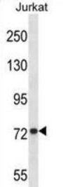 Mitofusin 1 (MFN1) Antibody