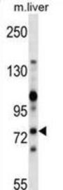 Mouse Zap70 Antibody