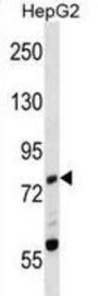 Mouse Zap70 Antibody